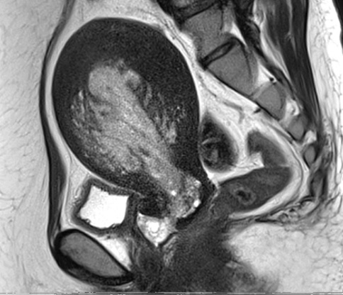 図2　MRI画像